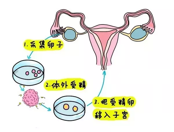 广州招聘捐卵女孩机构